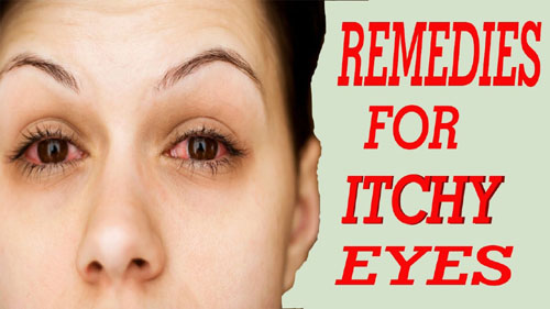 Home Remedies For Itchy Eyes 