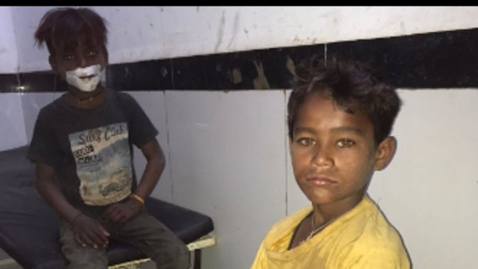 Children Begging On The Road Seriously Injured : भीख मांग रहे बच्चे हुए हादसे के शिकार, जिला अस्पताल में भर्ती