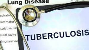 World Tuberculosis Day 2022