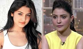 Bollywood actresses underwent surgery