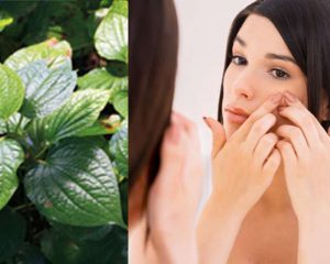 Benefits Of Betel Leaves For Skin in Hindi