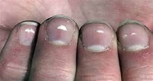 White Marks On Nails Tell Your Future