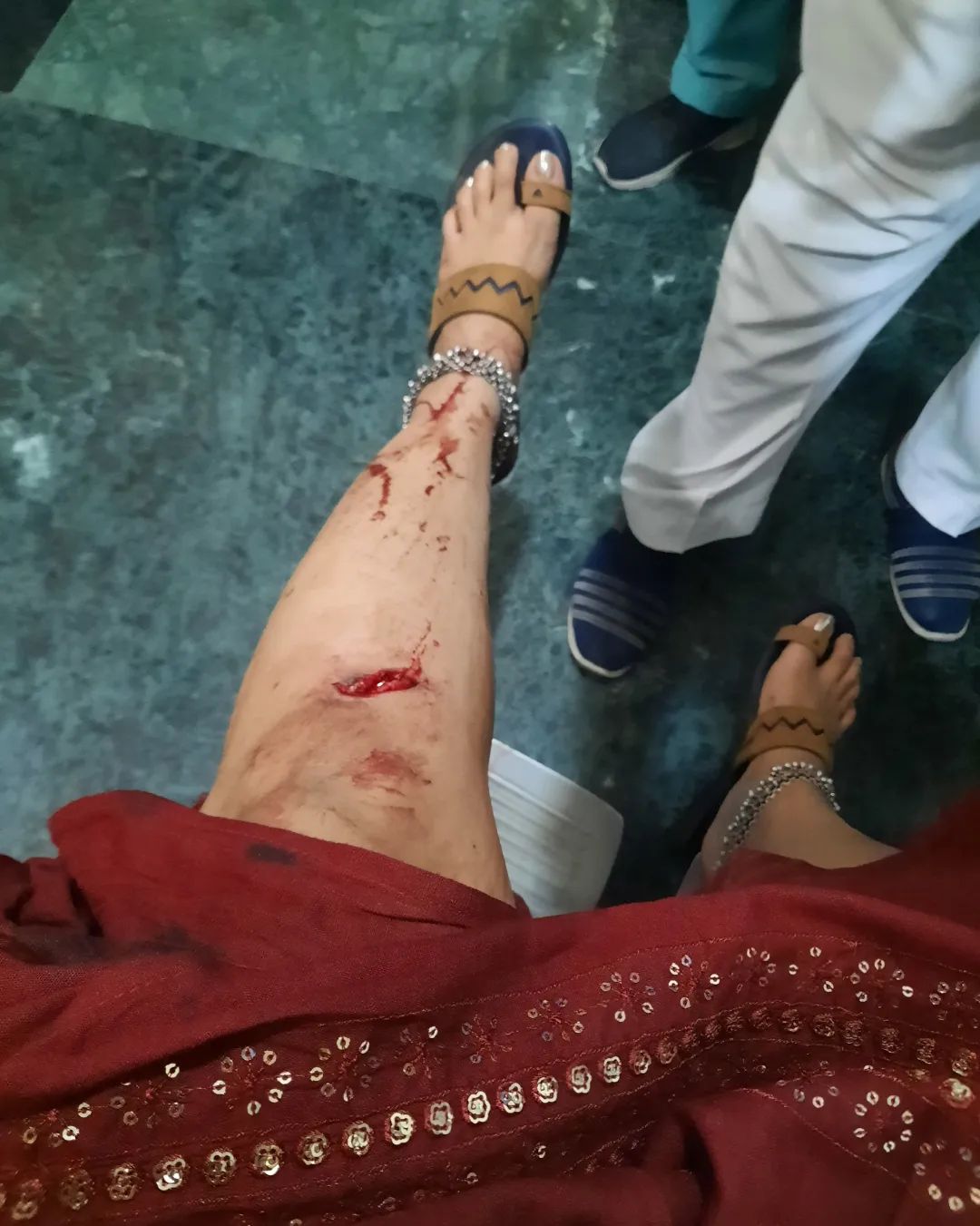 Tanushree Dutta Accident