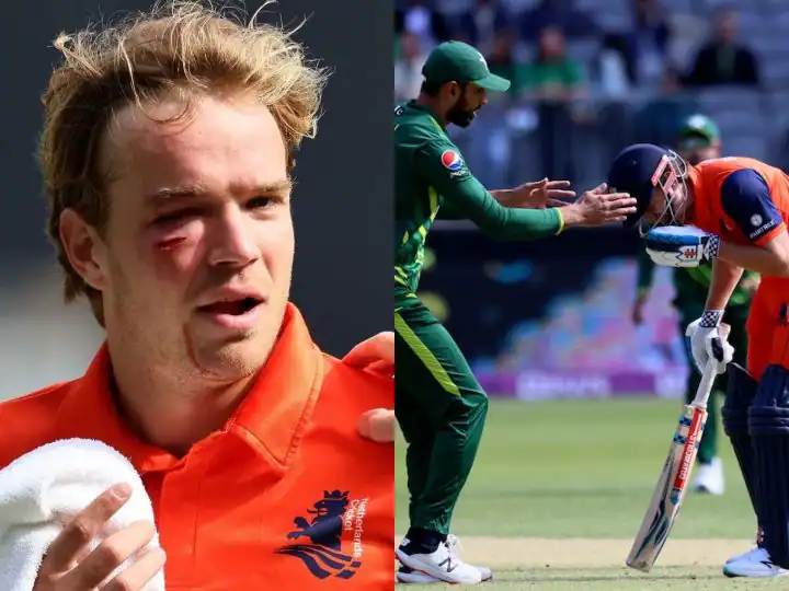 PAK vs NED T20 WC: मैच के दौरान रऊफ की खतरनाक गेंद की वजह से खून से लथ पथ हुआ नीदरलैंड्स का ये बल्लेबाज