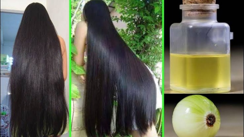 Healthy Hair: अगर आपको भी चाहिए घुटनों तक लंबे बाल, आंवला और प्याज को करें इस्तेमाल