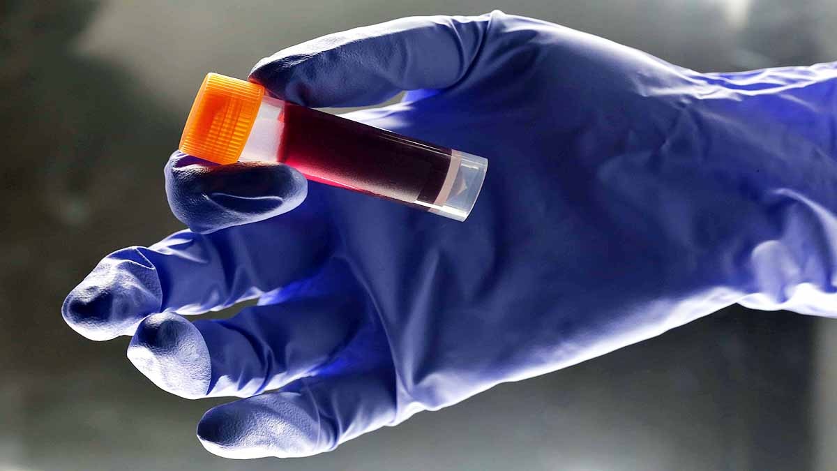 Golden Blood Group: गोल्डन ब्लड ग्रुप की एक बूंद सोने से भी ज्यादा है कीमती, जानें क्यों