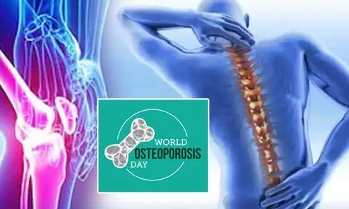 World Osteoporosis Day 2023: आज 'विश्व ऑस्टियोपोरोसिस दिवस' पर जाने इसका इतिहास और इस बीमारी का इलाज?