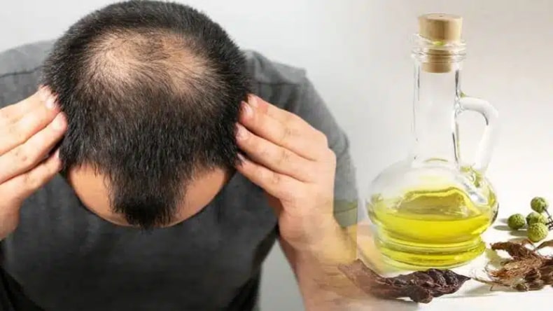 Hair Regrowth Oil: क्या आप भी गंजेपन से परेशान, इन घरेलू उपायों से मिलेगा समाधान