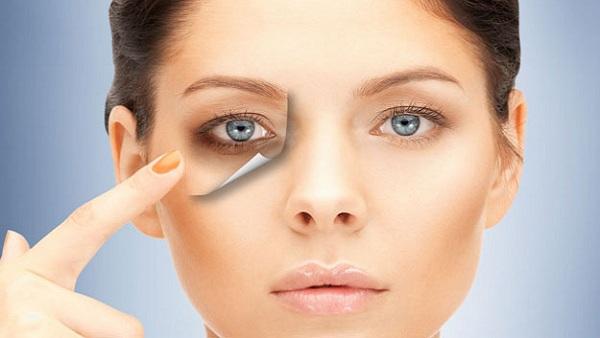 Dark Circles से छुटकारा पाने के लिए इन बातों का रखें खास ख्याल, ऐसे करें बचाव -Indianews