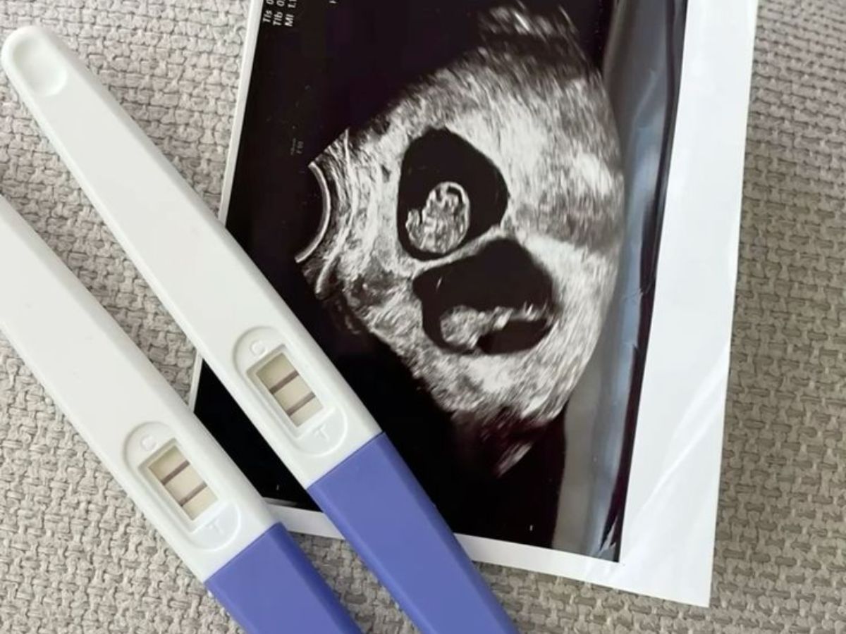 एक चौकने वाला खुलासा, क्या पुरुष भी हो सकते है Pregnant? ये एक मजाक नहीं बल्कि हो सकता है जानलेवा बीमारी का संकेत - Gallery Image