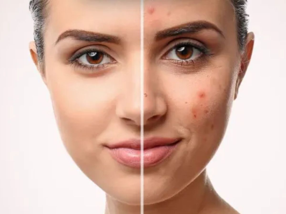 Neem Leaves Health Benefits - Photo Gallery