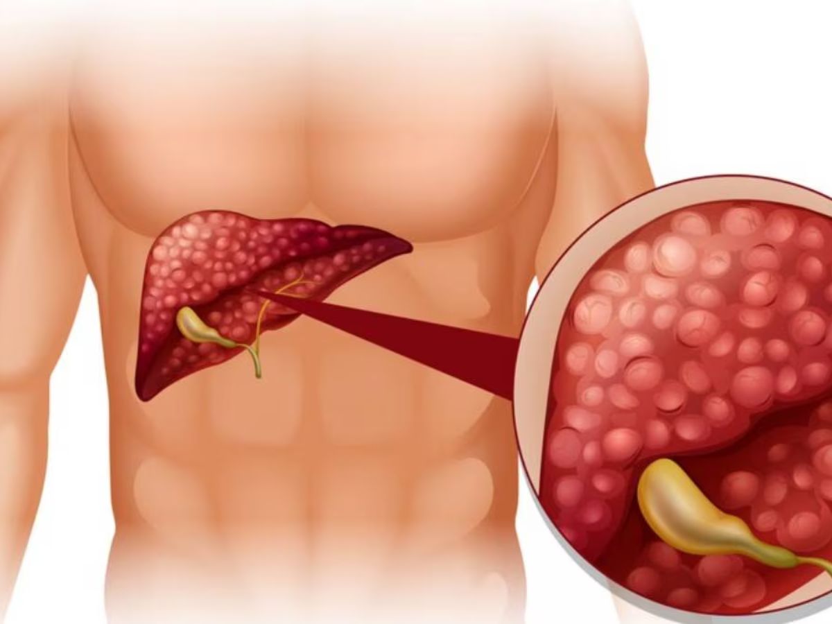 Anti-inflammatory Neem Benefits - Photo Gallery