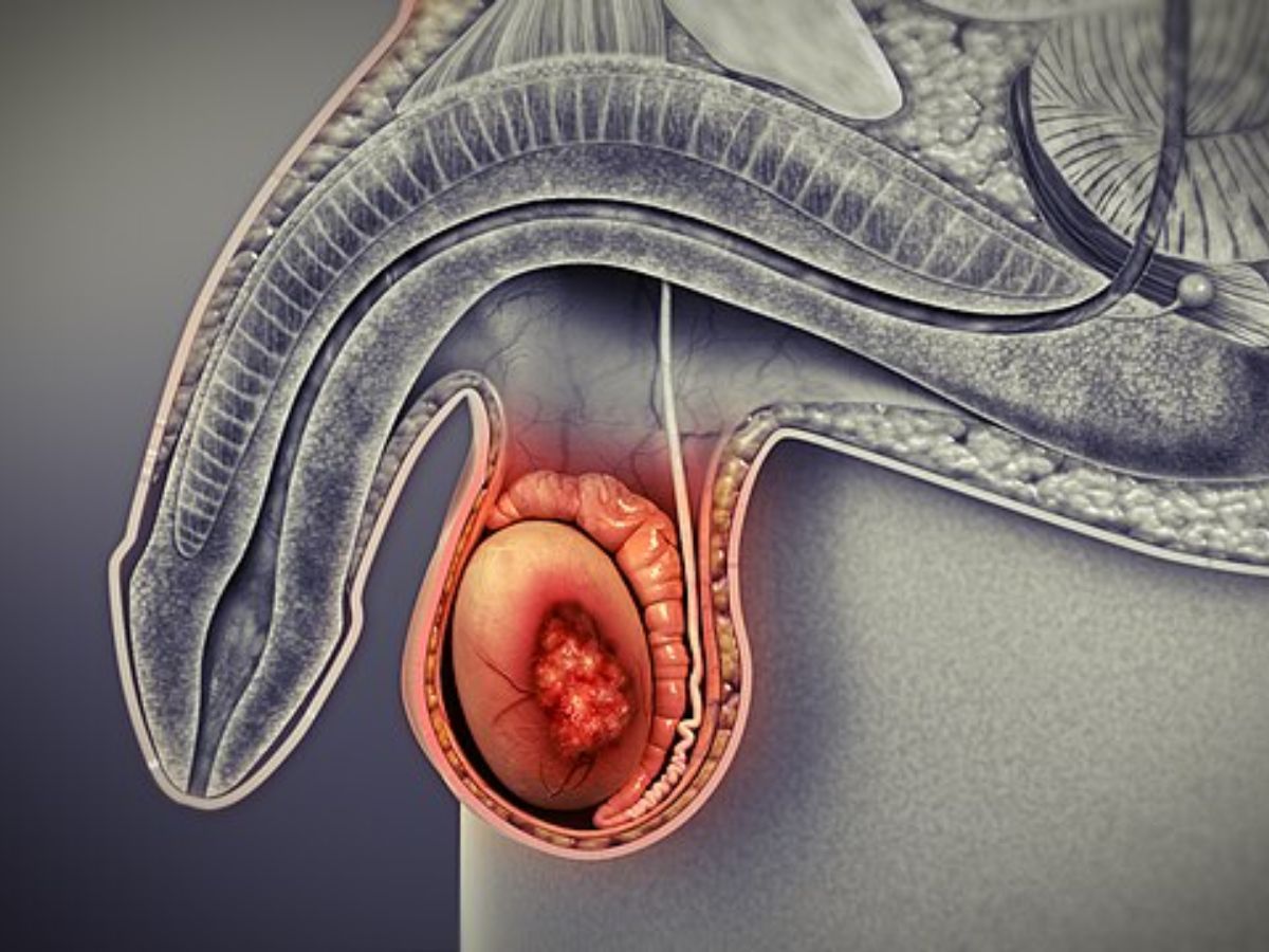 एक चौकने वाला खुलासा, क्या पुरुष भी हो सकते है Pregnant? ये एक मजाक नहीं बल्कि हो सकता है जानलेवा बीमारी का संकेत - Gallery Image