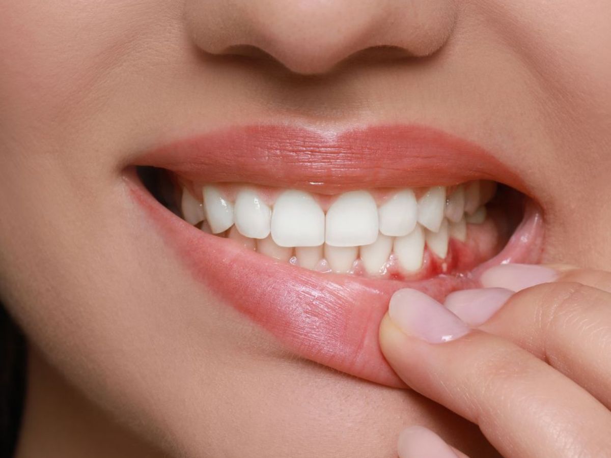 ब्रश के तुरंत बाद चाय कर सकती है आपके दांतो की उम्र कम, जानें क्यों है हानिकारक? - Gallery Image