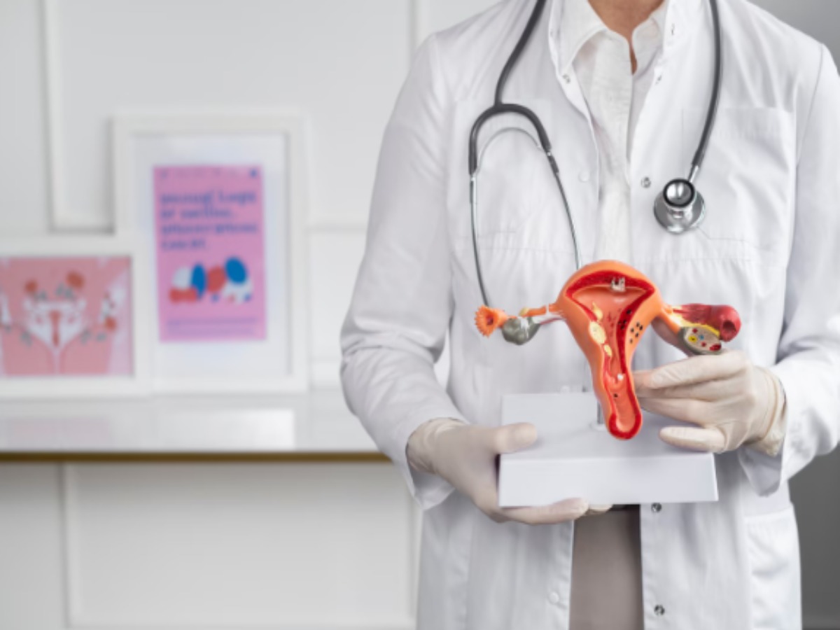 What is PCOS - Photo Gallery