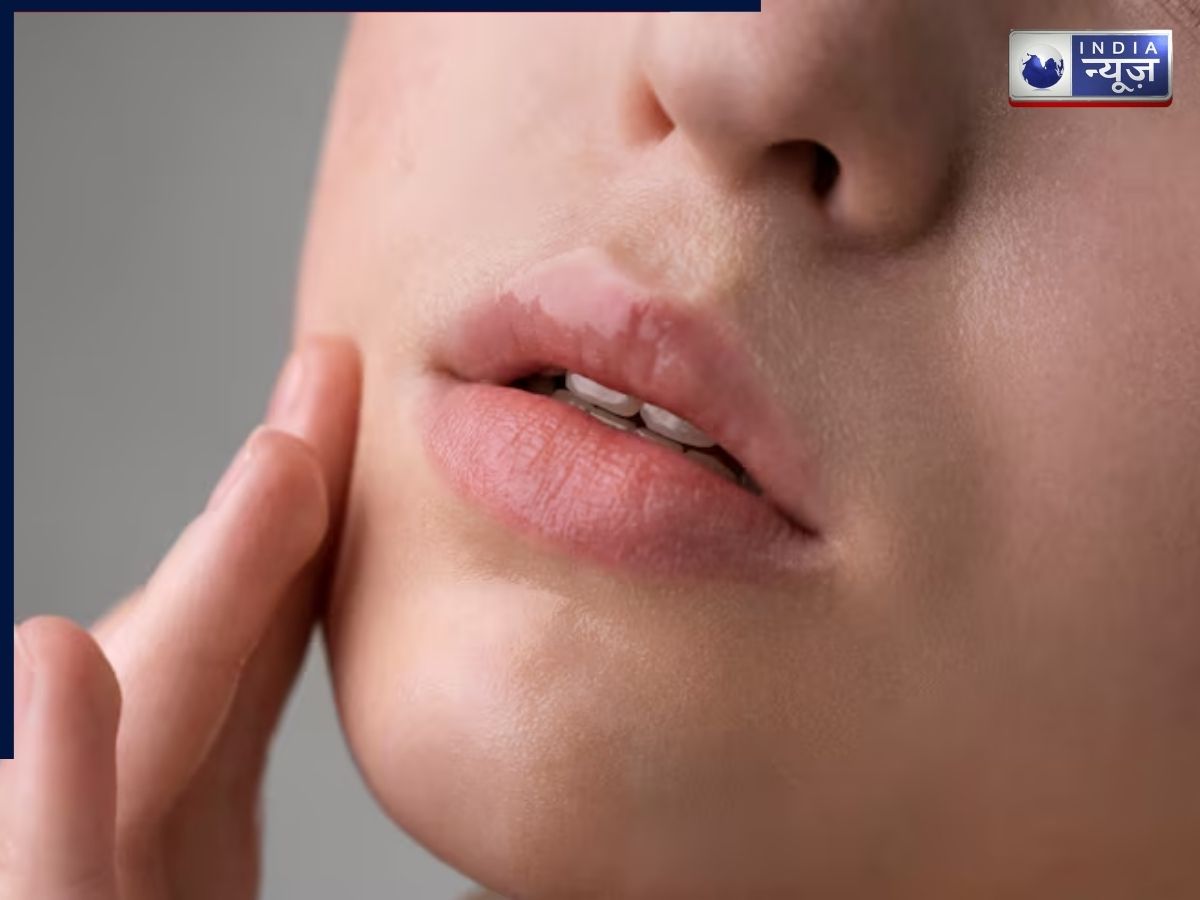 What Experts Says on Lip health Signs - Photo Gallery