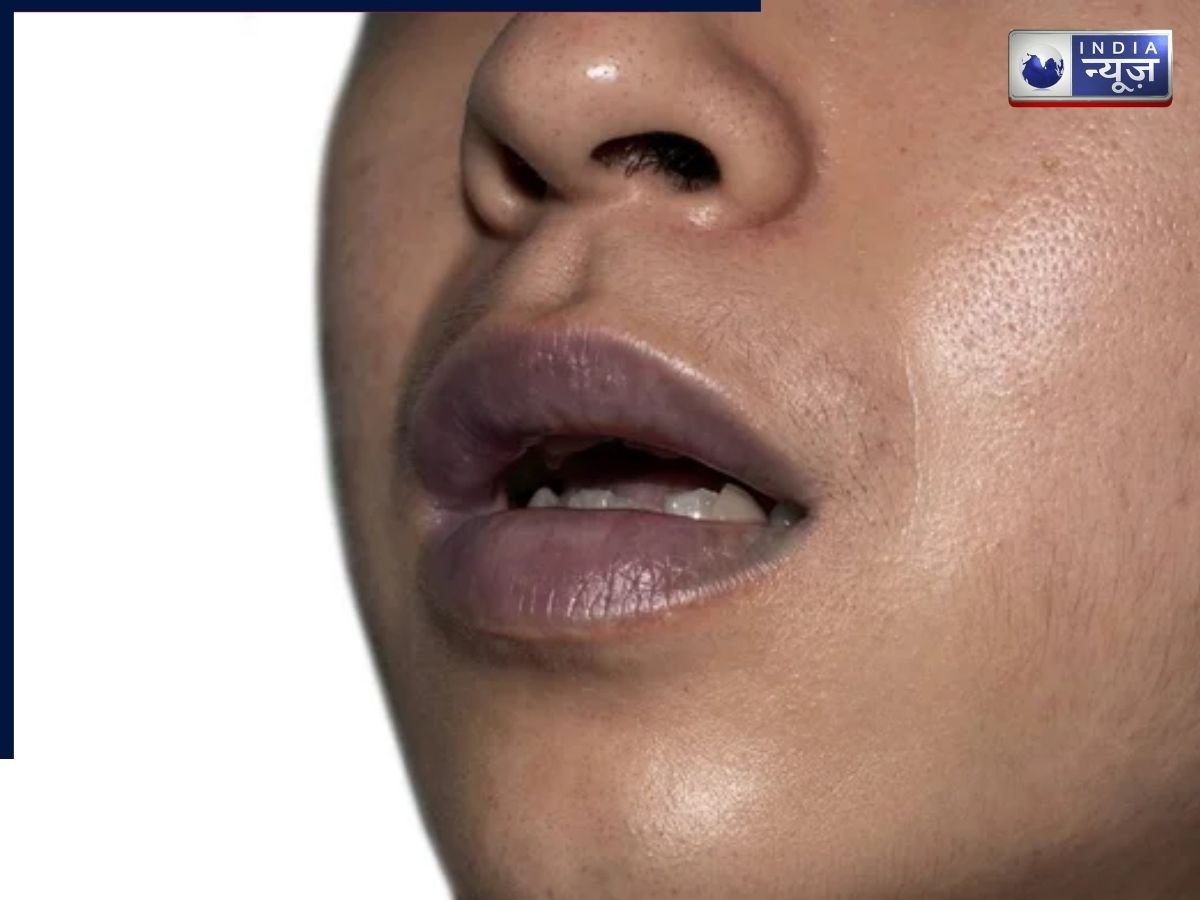 Blue Lips - Photo Gallery