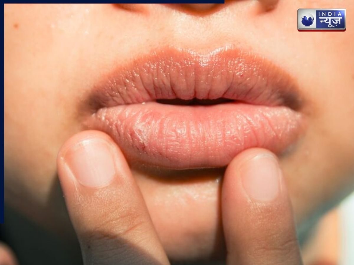 Swollen Lips - Photo Gallery