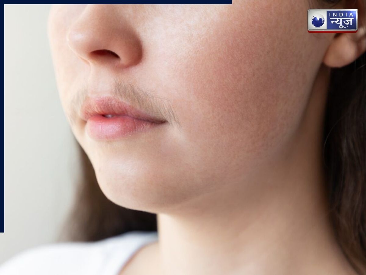 क्यों उग रही हैं महिलाओं की दाढ़ी-मूंछ? कॉस्मेटिक समस्या या सेहत के लिए खतरा, रूसी डॉक्टर ने दी चेतावनी