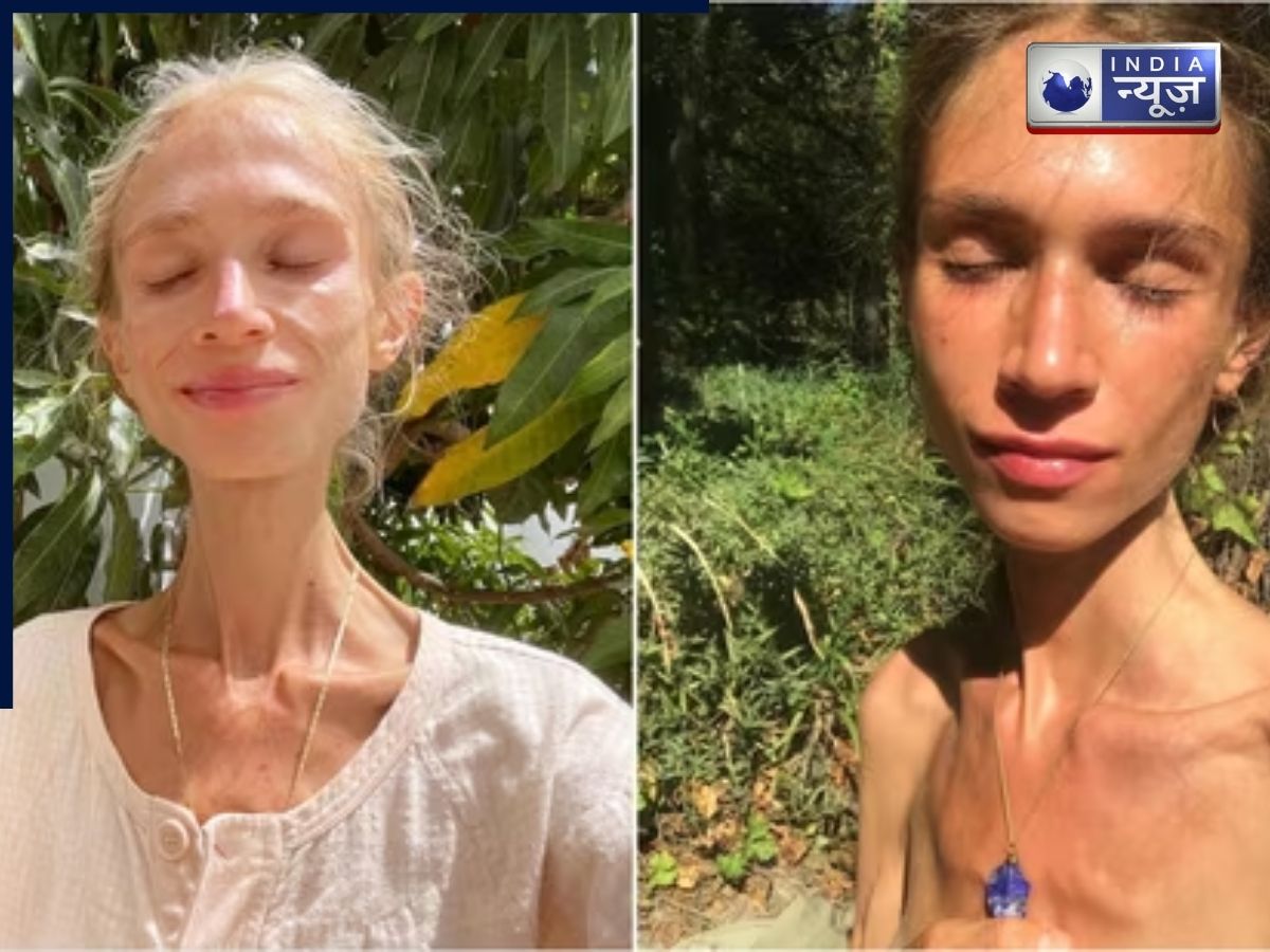 क्या फलाहार पर रहना सही है? इससे 27 वर्षीय महिला की हुई मौत, वजह कुपोषण