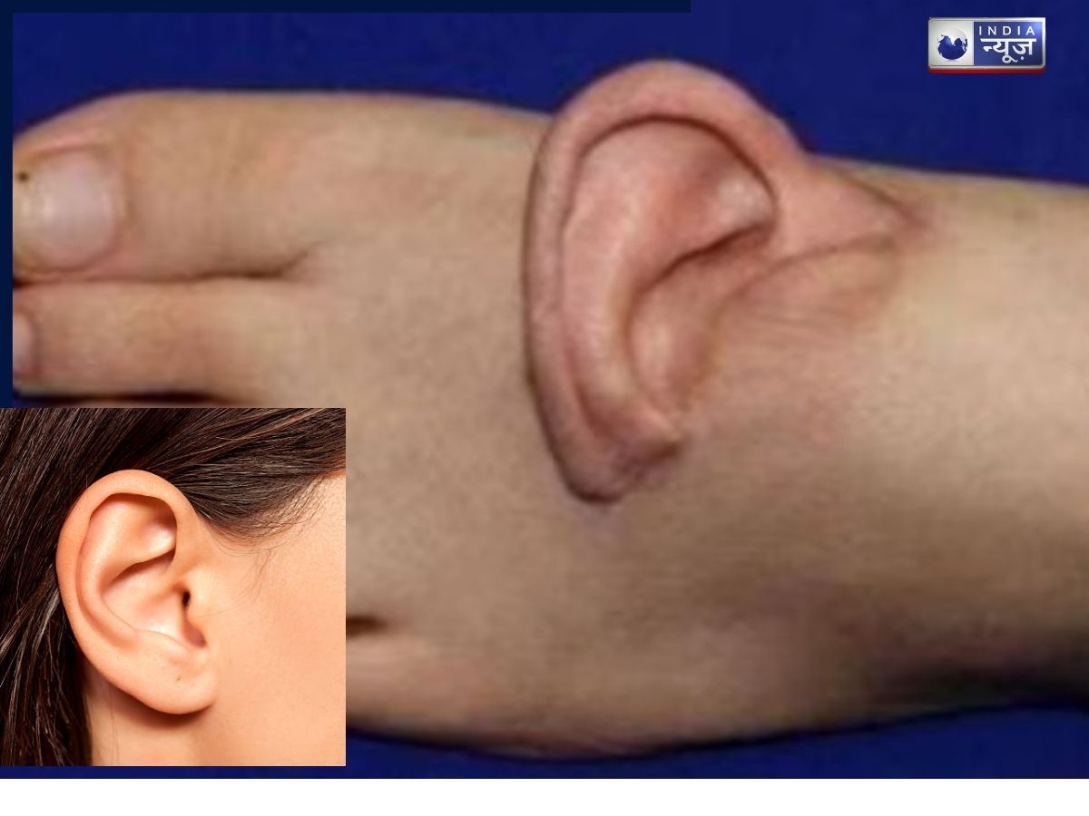 चीनी डॉक्टरों ने पैर में उगाया कान, फिर हुआ ऐसा कमाल; कर डाली दुनिया की सबसे मुश्किल सर्जरी