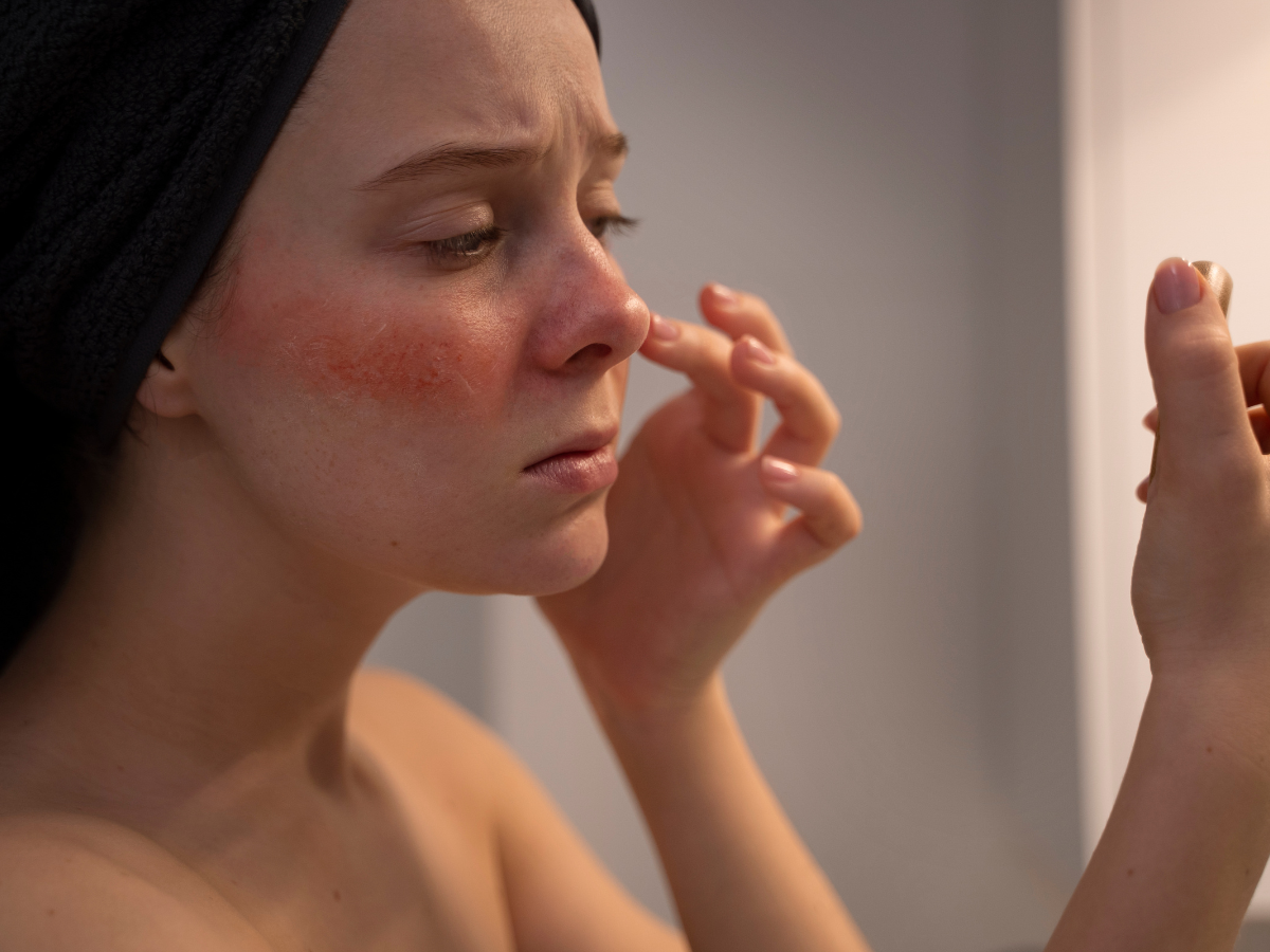 Ignoring Your Skin Type - Photo Gallery