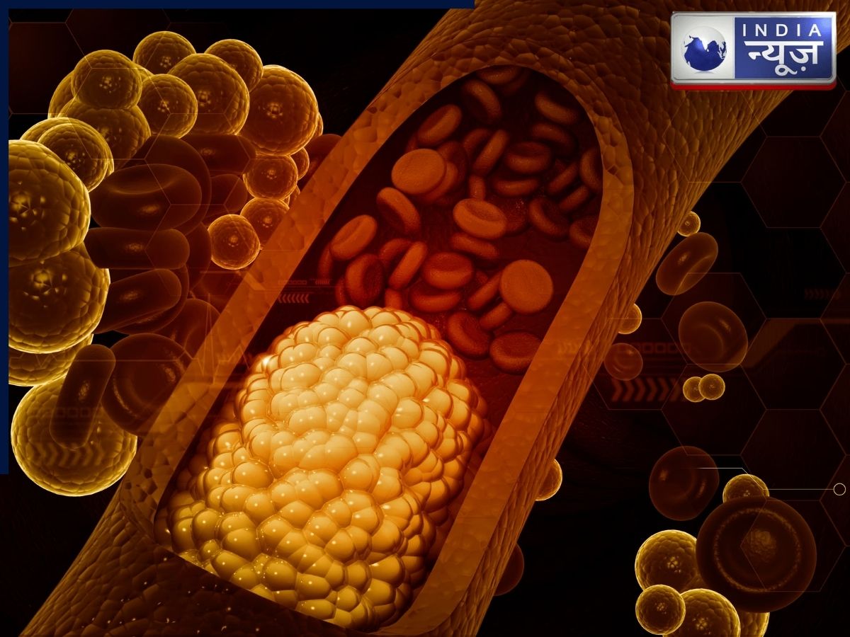 उच्च कोलेस्ट्रॉल के शुरुआती लक्षण, इन्हें अनदेखा न करें, नहीं तो हो सकती है ये गंभीर समस्या!