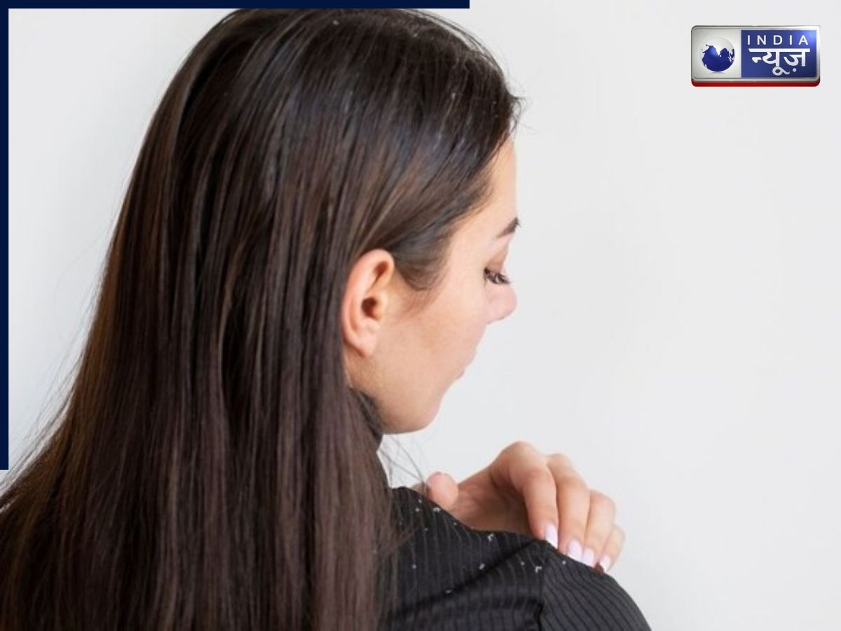 डैंड्रफ खत्म करने का सस्ता इलाज! घर पर सिर्फ 10 रुपये में बनाएं शैम्पू