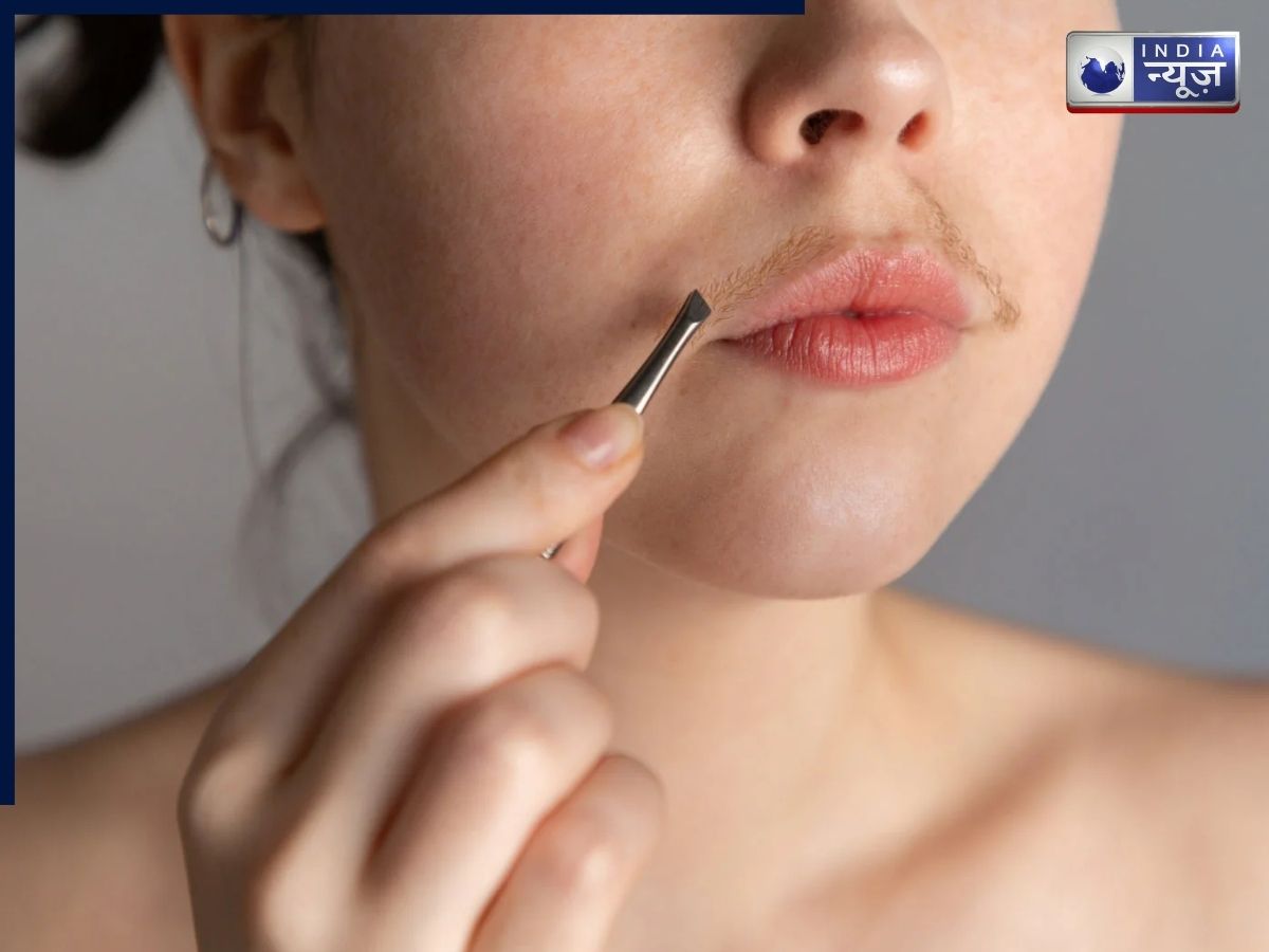 Women Developing beard moustache - Photo Gallery