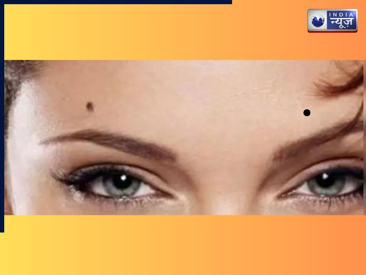 moles on lucky females - Photo Gallery