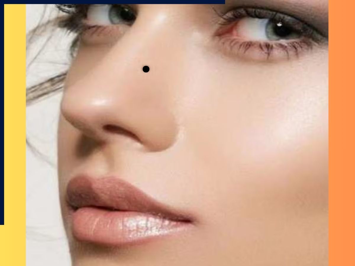 moles on lucky females - Photo Gallery