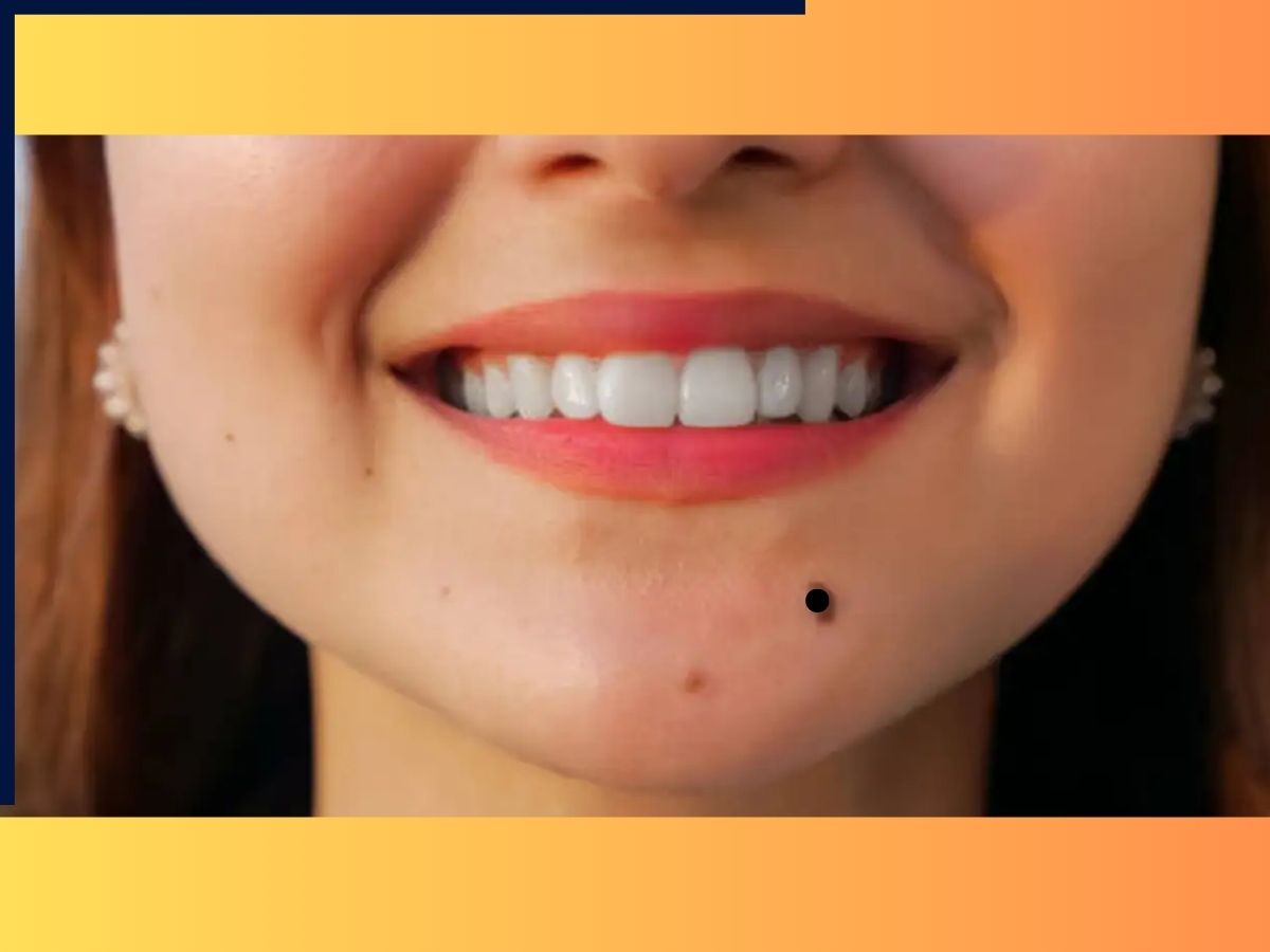 moles on lucky females - Photo Gallery