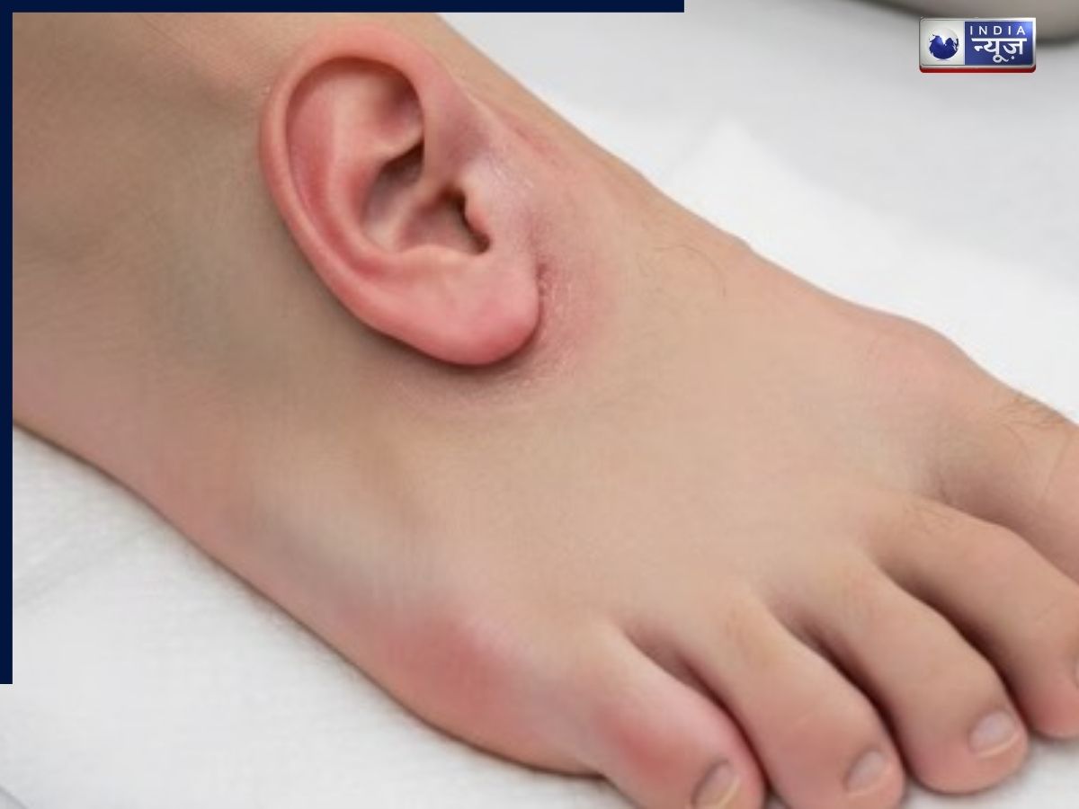 Chinese Woman Ear Transplant: 5 महीने तक पैर पर चिपका रहा कान, चीन के डॉक्टरों की सर्जरी से हर कोई हैरान