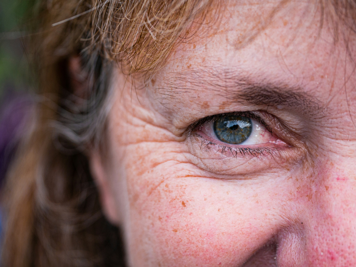 Prevents Premature Aging - Photo Gallery