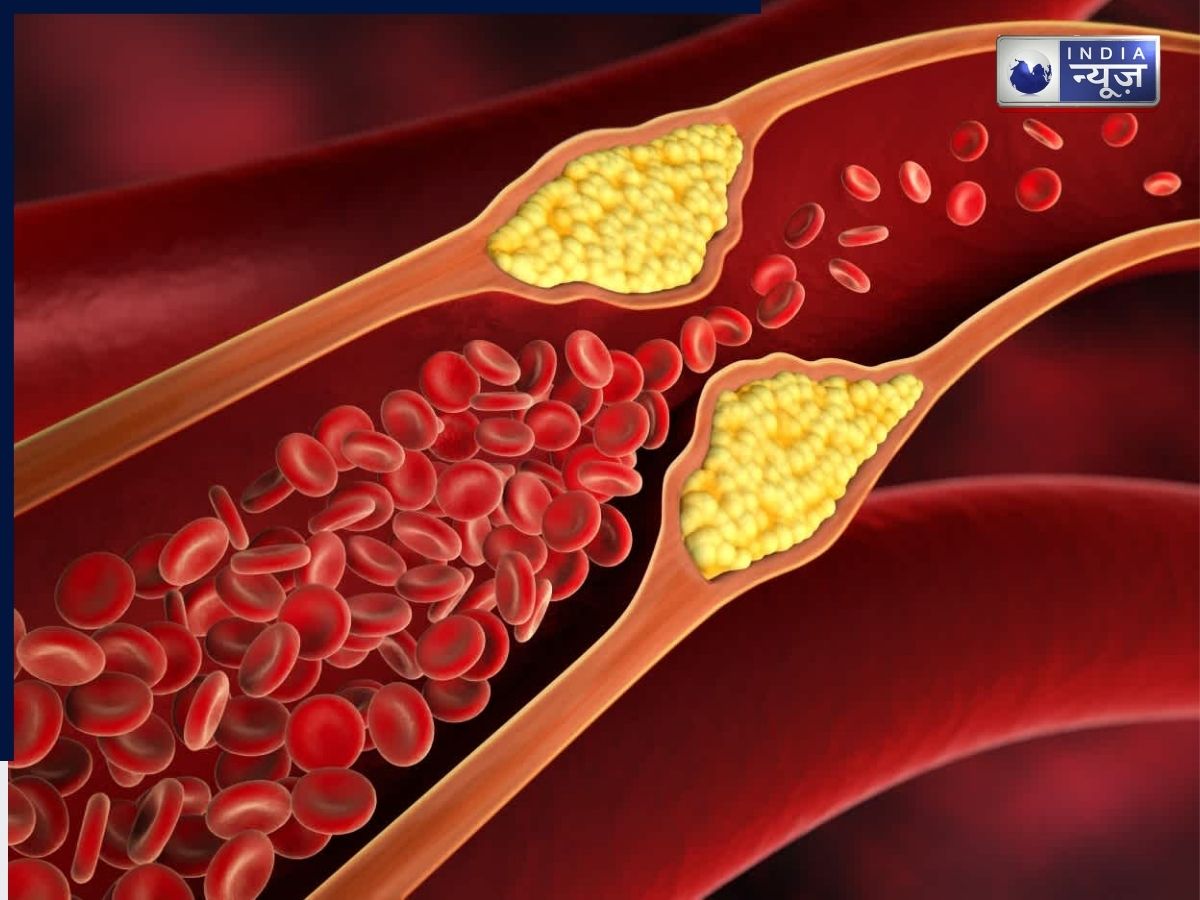 reduces cholestrol - Photo Gallery