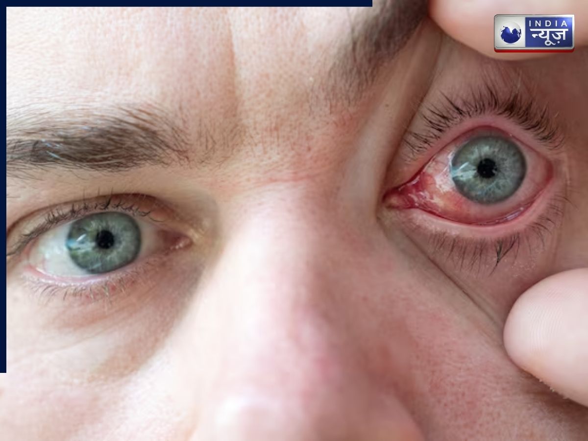 Temporary Loss of Vision - Photo Gallery