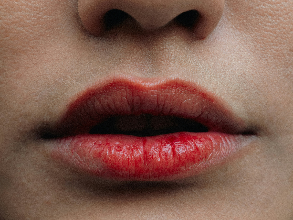 Why Lip Care Matters - Photo Gallery