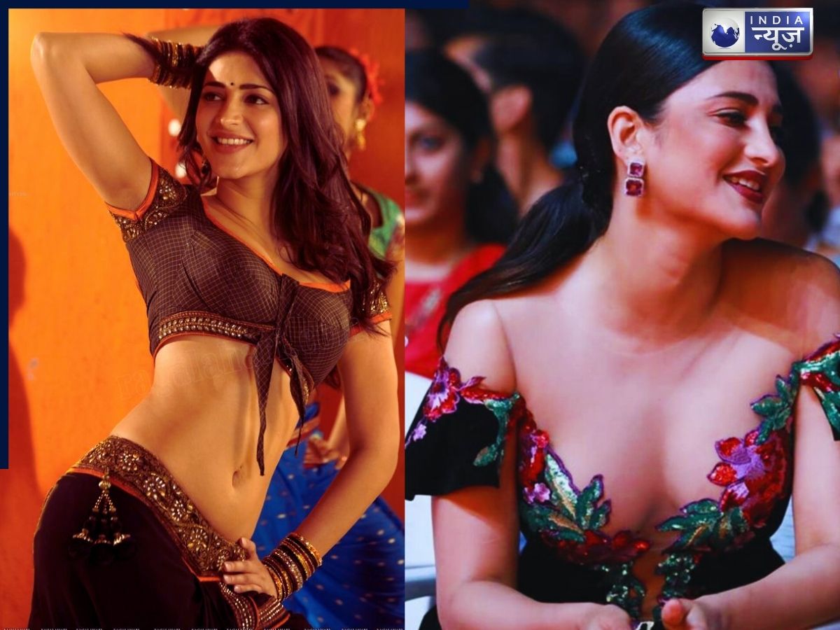 Nose surgery - Photo Gallery