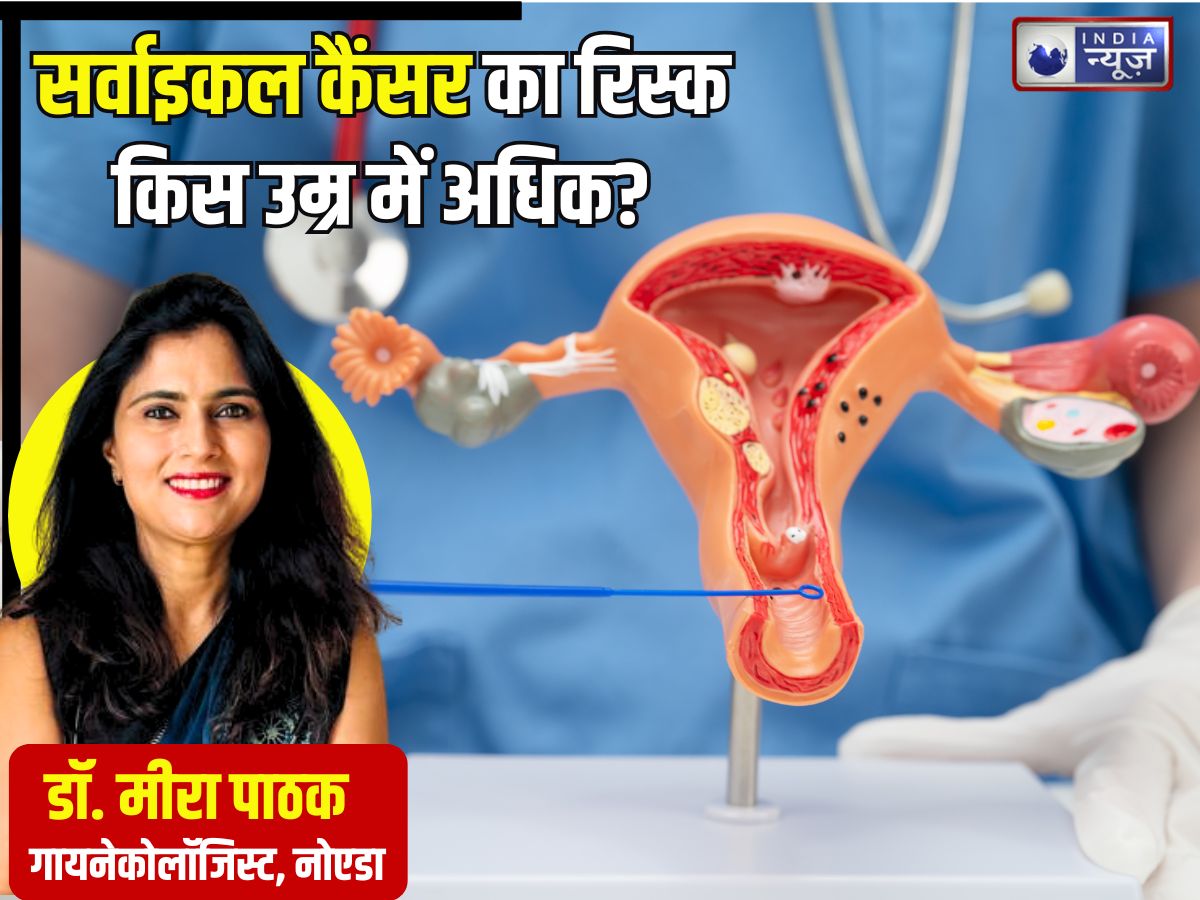 महिलाओं में सर्वाइकल कैंसर किस उम्र में अधिक होता है? 30, 40 या फिर 55 से ऊपर, डॉक्टर से जानें बचाव के उपाय