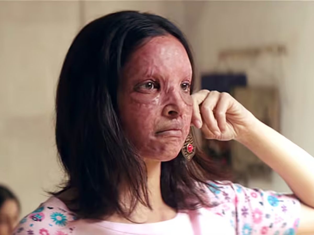 chhapak - Photo Gallery