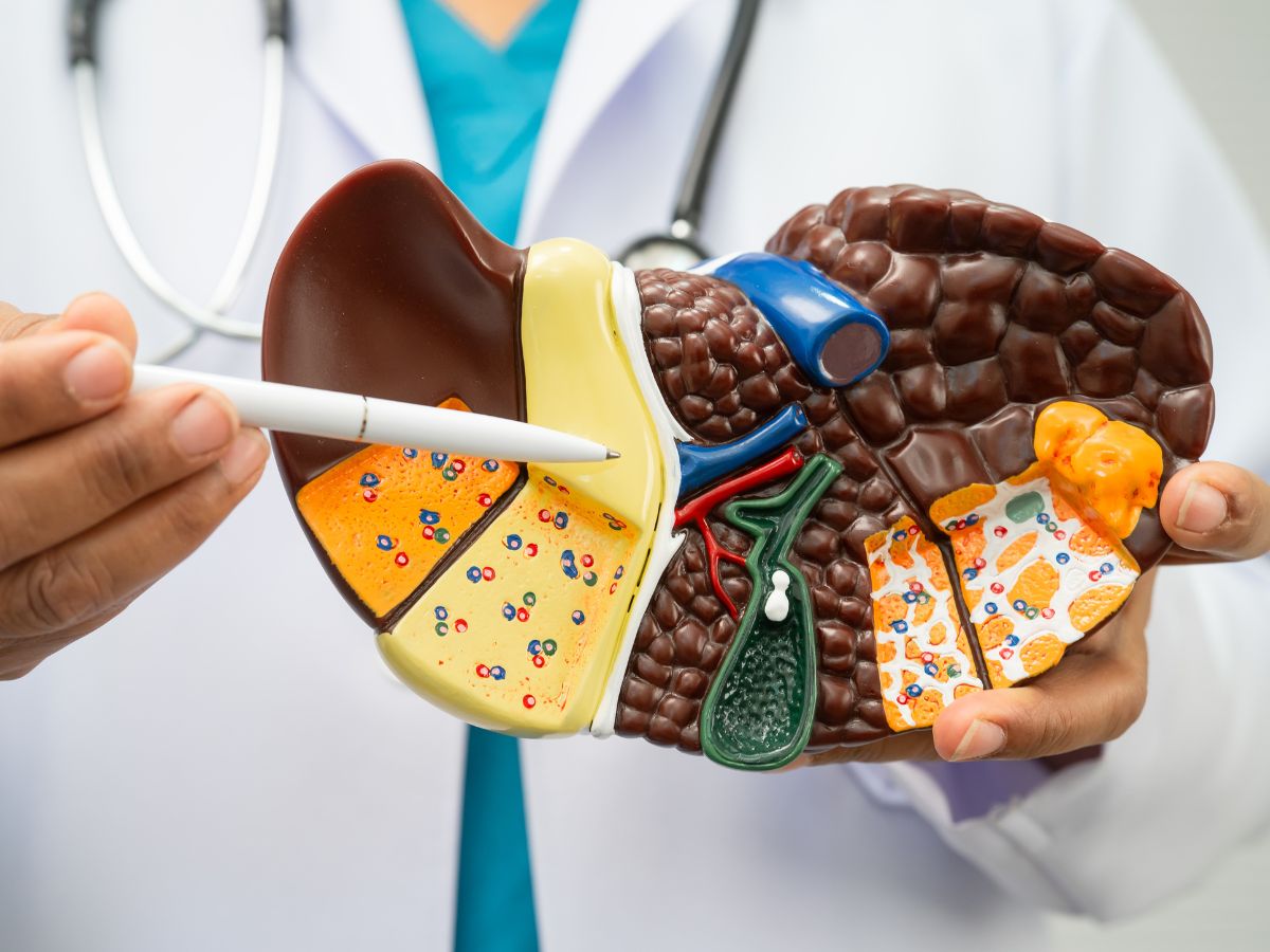 Liver Cleansing Diet - Photo Gallery