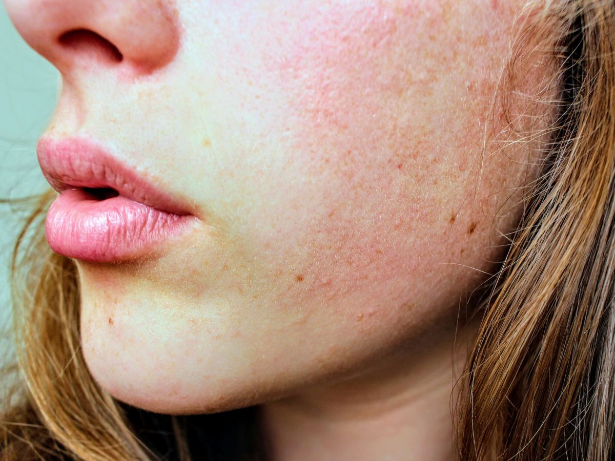 Omega 3 Deficiency: दिल और दिमाग हो जाएगा कमजोर… अगर शरीर में इस तत्व हो गई कमी! जानिए कैसे करें इसकी पूर्ति - Gallery Image