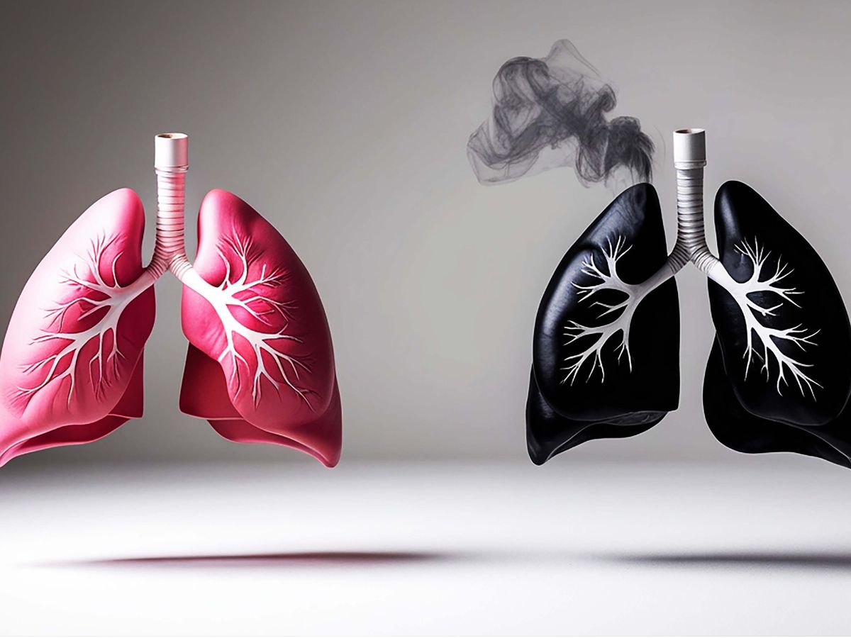 जहरीले पॉल्यूशन का फेफड़ों पर हमला, शरीर बन रहा बीमारियों का घर, लंग्स बचाने के लिए खाना शुरू कर दें ये चीजें - Gallery Image