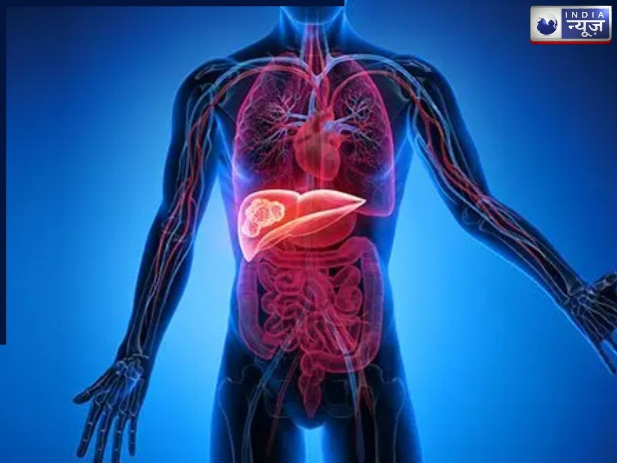 यह खराब लाइफस्टाइल फैटी लिवर को कहीं न बना दे कैंसर का खतरा! जानें क्या है बचने का तरीका?