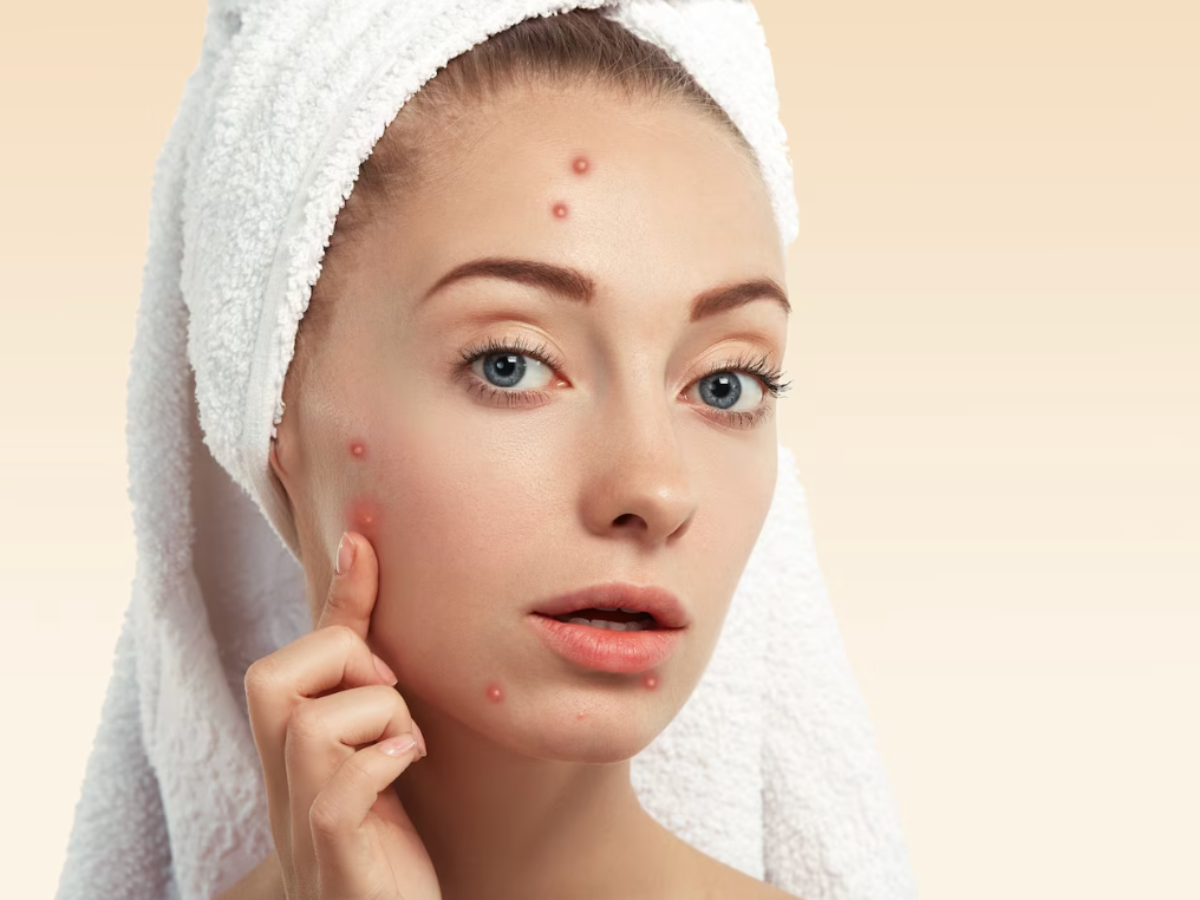 Same Skin Issues Different Solutions - Photo Gallery