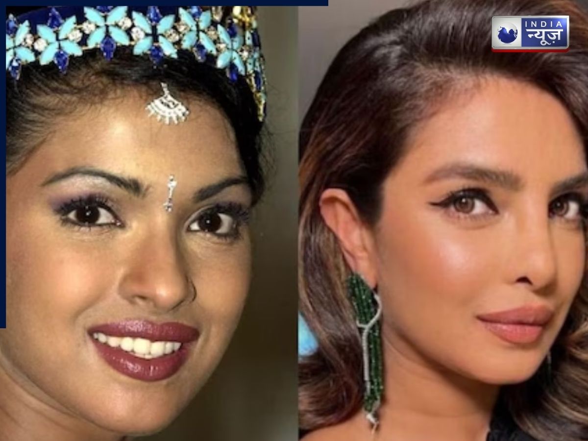 खूबसूरती का राज या सर्जरी का खेल? वो सितारे जिन्होंने चेहरा तो बदला पर सच नहीं स्वीकारा