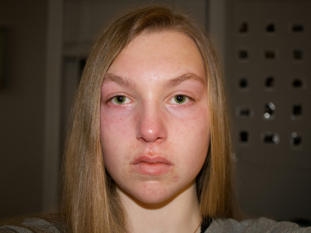 Tingling Doesnt Mean Its Working - Photo Gallery