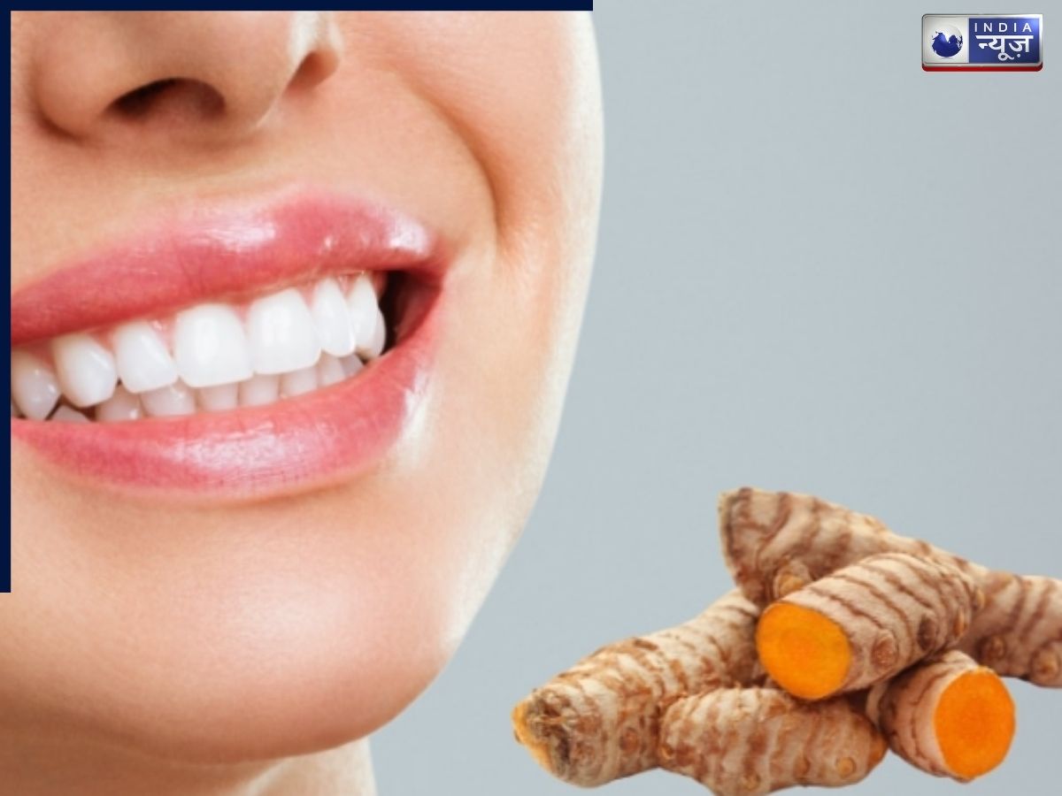 क्या आप भी हल्दी का ज्यादा करते हैं इस्तेमाल, अभी से कर दें बंद, नहीं तो गायब हो जाएगी आपके दांतों की चमक