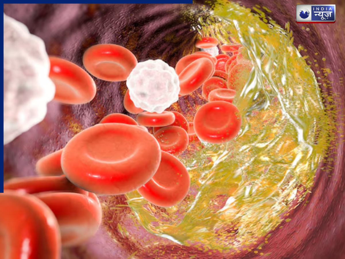 Bad Cholesterol: दिल ही नहीं दिमाग के लिए भी हानिकारक है बैड कोलेस्ट्रॉल, जानें क्यों बढ़ता है LDL?
