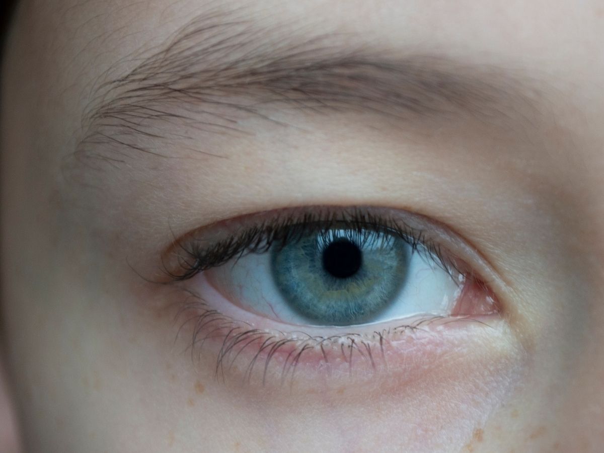 congenital disease Coloboma in child - Photo Gallery